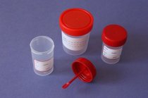 Контейнер для сбора биологических жидкостей стерильный 120 мл PLASTI LAB Контейнер для сбора биологических жидкостей стерильный 120 мл PLASTI LAB